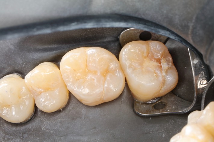 Scott Kanamori #2 pre-op