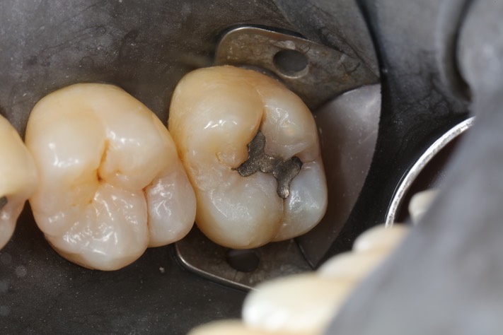 Scott Kanamori #2 pre-op