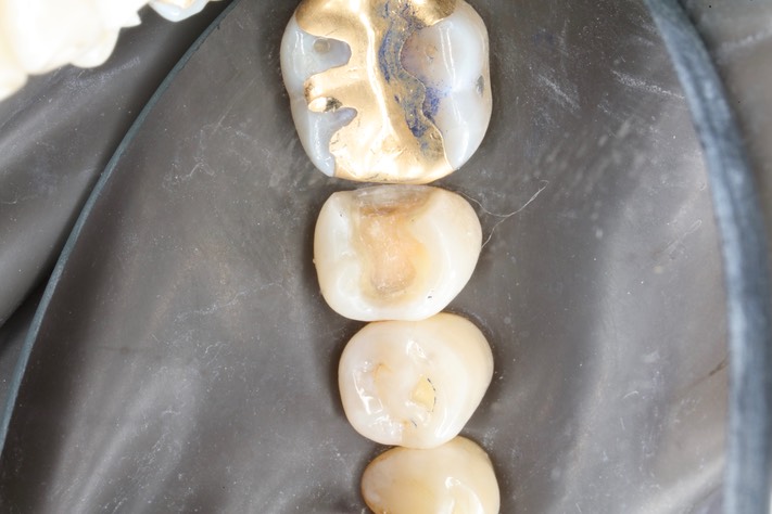 Scott Kanamori #29 prep