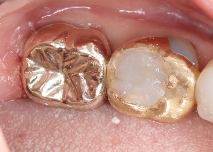 Scott Kanamori #31 finish