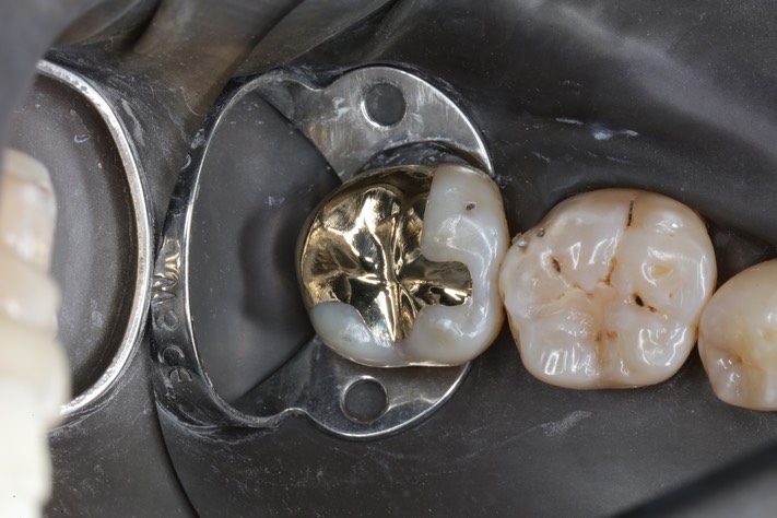 Scott Kanamori #31 finish