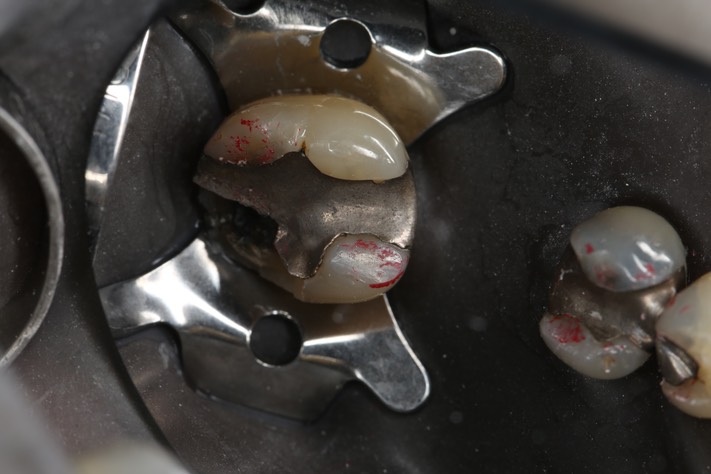 Scott Kanamori #31 pre-op