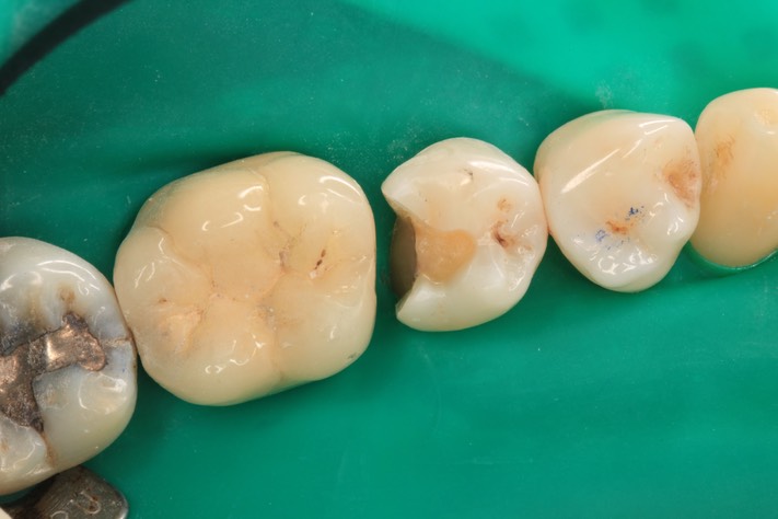 Scott Kanamori #29 prep