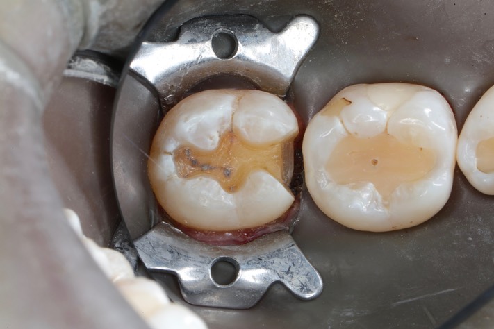 Sott Kanamori #31 prep