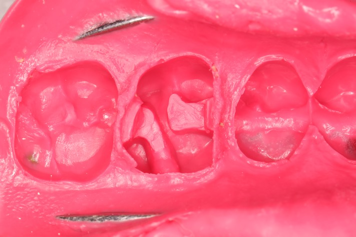 Ted Kanamori #14 impression