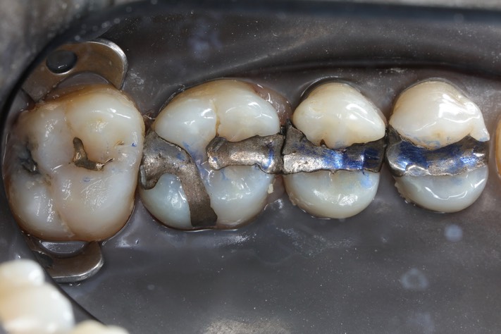 Ted Kanamori #14 pre-op