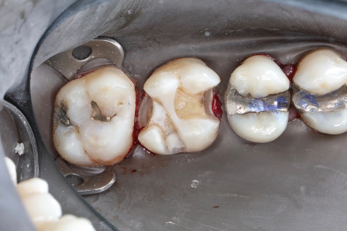 Ted Kanamori #14 prep