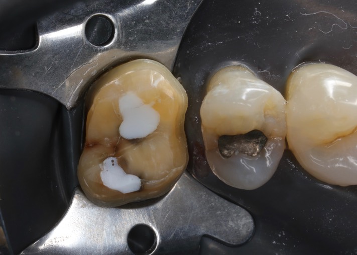 Ted Kanamori #14 prep