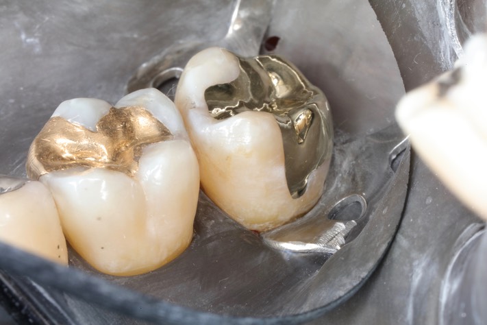 Ted Kanamori #15 finish