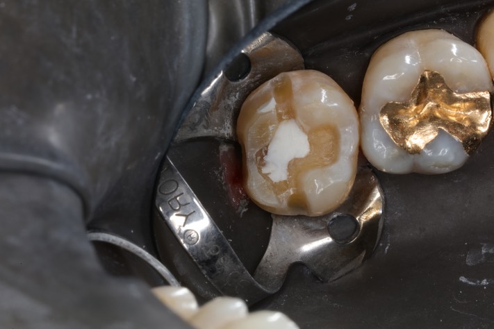 Ted Kanamori #15 prep