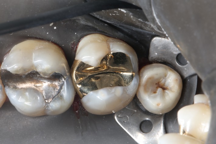 Ted Kanamori #15 finish