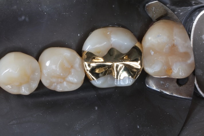 Ted Kanamori #19 finish