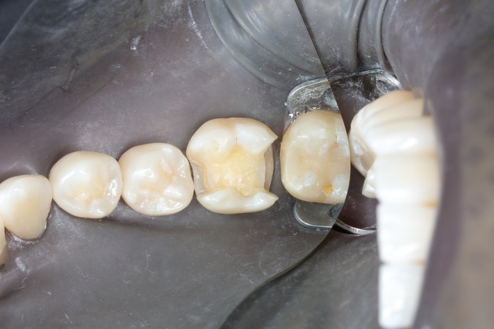 Ted Kanamori #19 prep