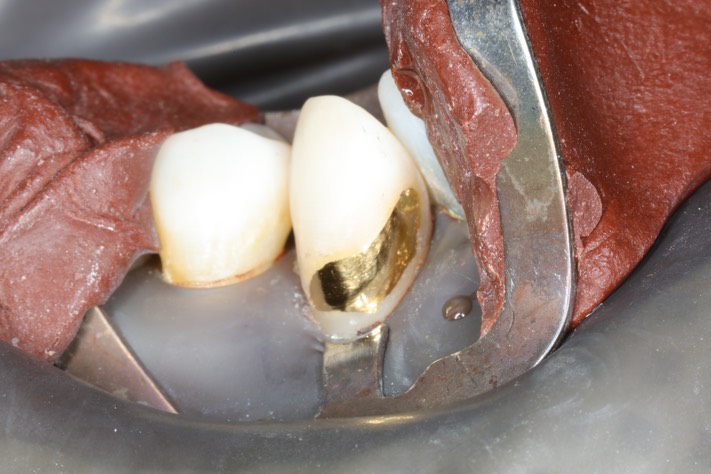 Ted Kanamori #27 finish 2