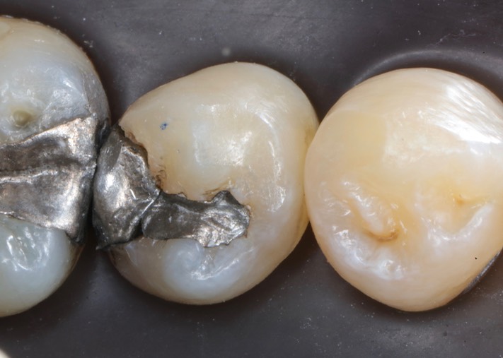 Ted Kanamori #29 pre-op