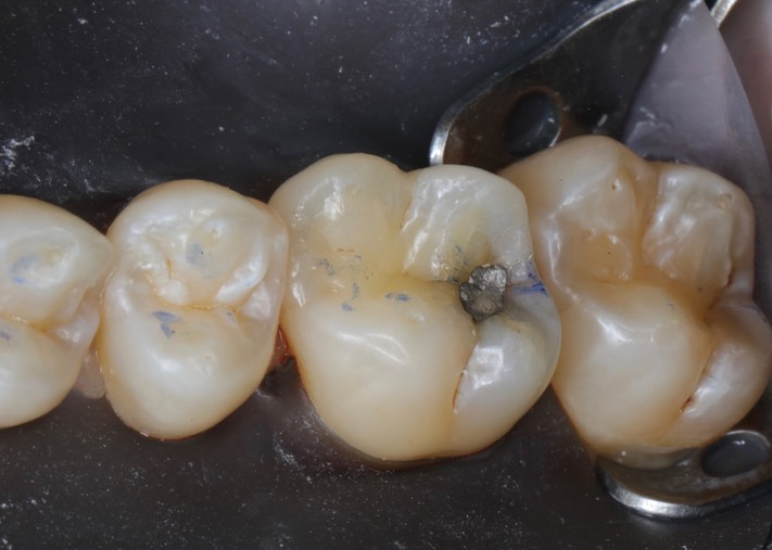 Ted Kanamori #3 pre-op