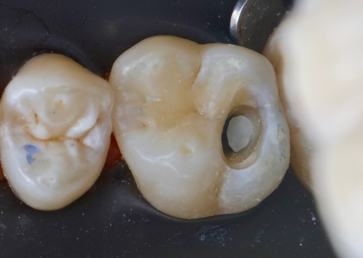 Ted Kanamori #3 prep