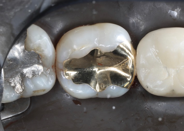 Ted Kanamori #31 finish