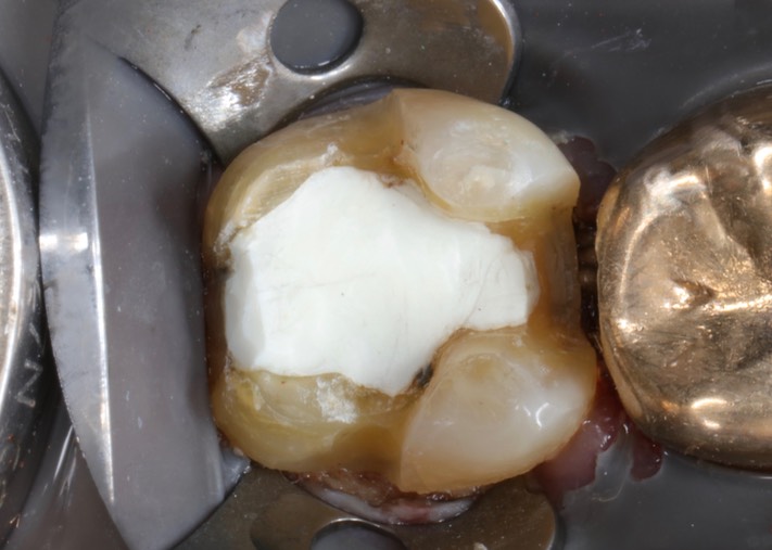 Ted Kanamori #31 prep