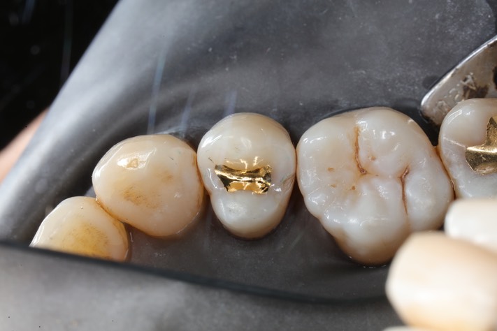 Ted Kanamori #4 finish