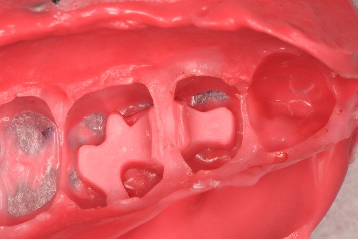 Ted Kanamori #13-14 impression