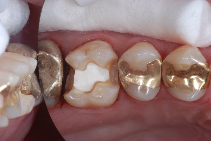 Terry Young #14 prep