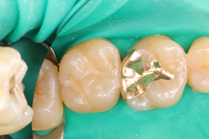 Wayne Chin #15 pre-op