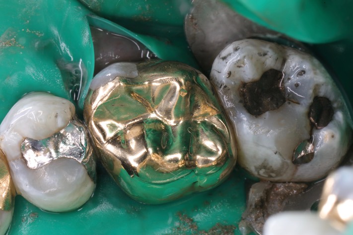 Wayne Chin #3 finish