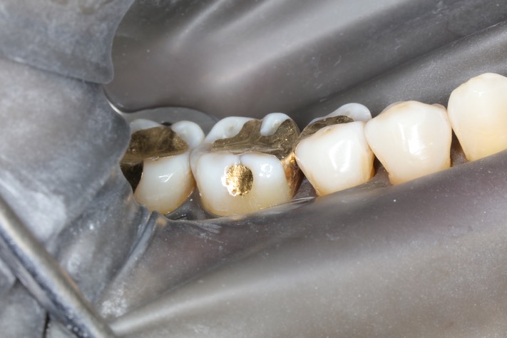 Wayne Chin #30 finish