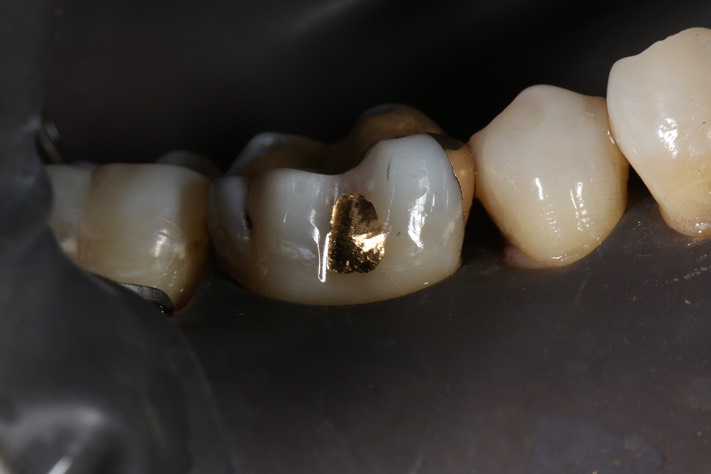 Wayne Chin #30 finish