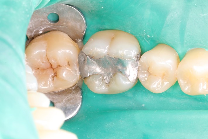 Wayne Chin #30 pre-op