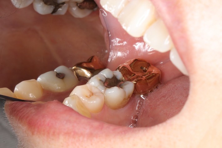 Wayne Chin #30 pre-op