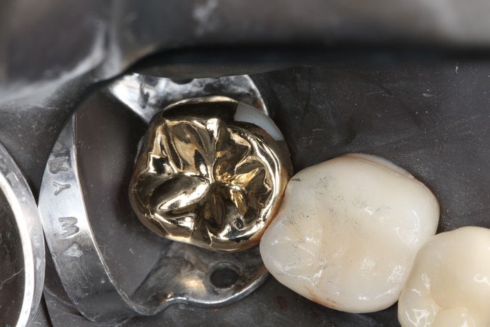 Wayne Chin #31 finish