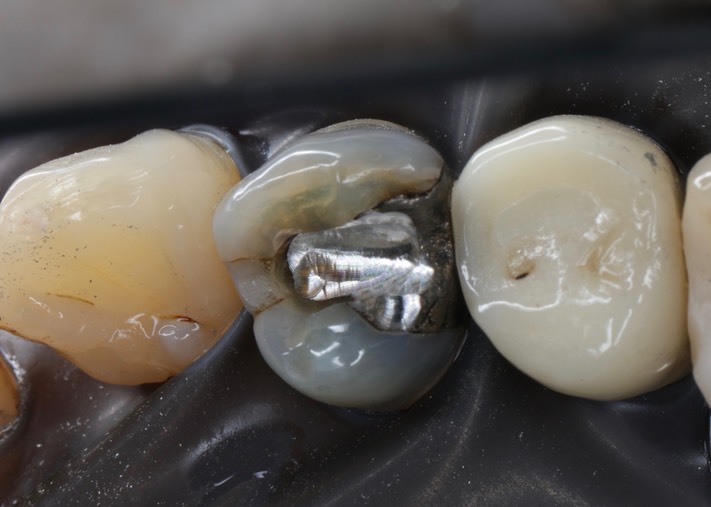 Wayne Chin #5 pre-op